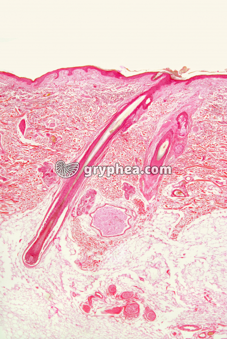 Peau humaine CT x5 - gryphea.com